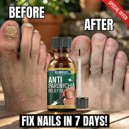 Anti Paronychia Relief Oil - (Buy_1_Get_1 _FREE)