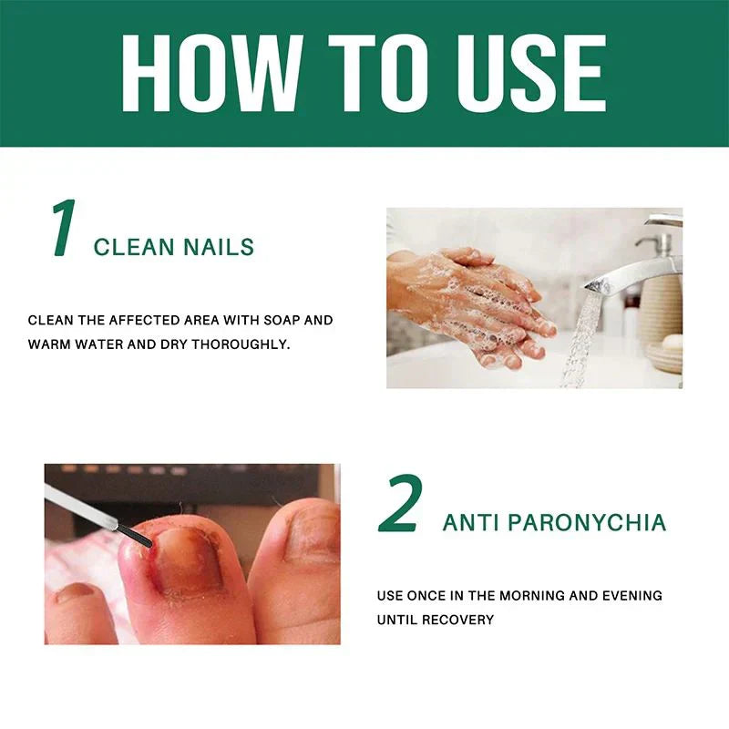 Anti Paronychia Relief Oil - (Buy_1_Get_1 _FREE)