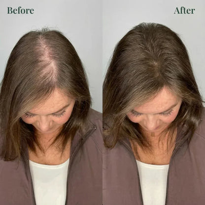 Kerarose Rosemary Shampoo For Hair Growth ( Buy 1 Get 1 Free 🔥)